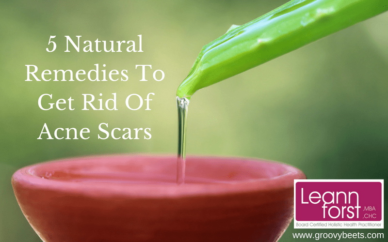 5 Natural Remedies To Get Rid Of Acne Scars Leann Forst 0730