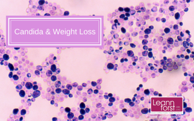 Candida and Weight Loss