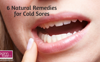 6 Natural Remedies for Cold Sores
